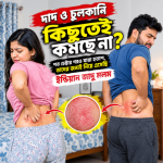 দাদ, দাউদ, পাঁচড়া, পচড়া, খোস পাঁচড়া, চুলকানি, দাদ চুলকানি, চর্মরোগ, ছুলি, ঘা, ফাঙ্গাল ইনফেকশন, ভেষজ মলম, রিংওয়্যার্ম, dad, daoud, pasra, ringworm, ringworm cream, skin infection, fungal infection, anti-fungal ointment, scabies